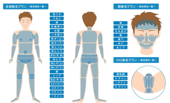 メンズ脱毛電気