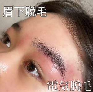 眉毛脱毛pinsia.jpg
